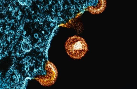 replicating hiv 14 virus particles