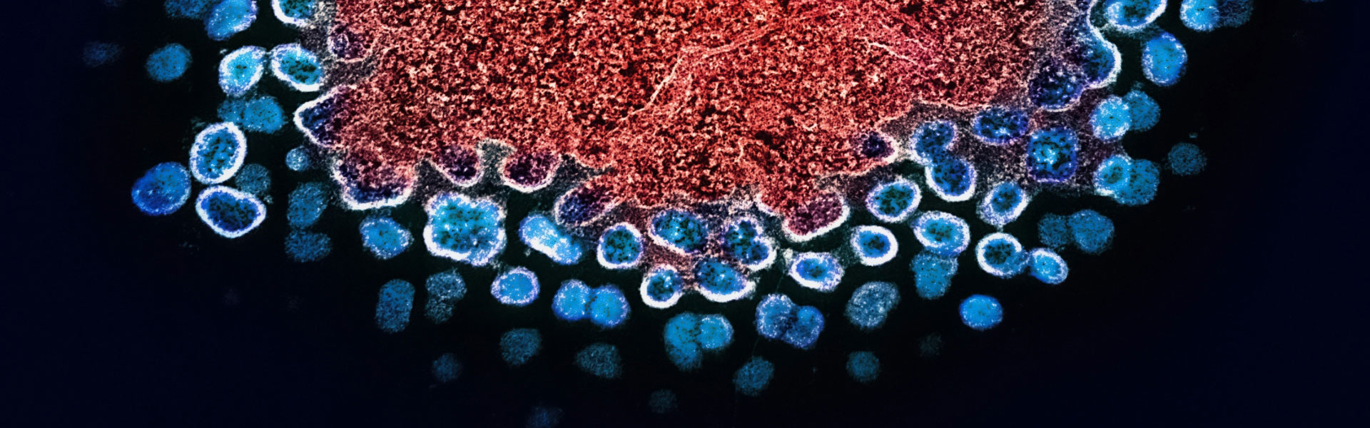 号称“百分百有效预防”艾滋病长效疗法已获批上市，但仍需警惕