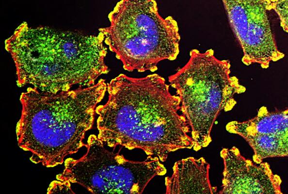 开启肿瘤治疗新纪元