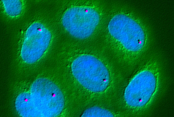 ROR1-肿瘤治疗策略多样化靶点