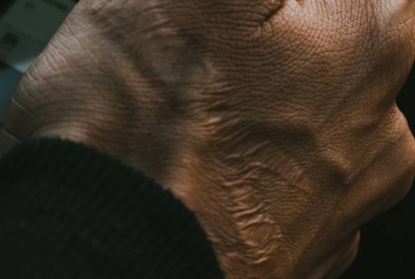 组织纤维化不可逆转进程或可终结