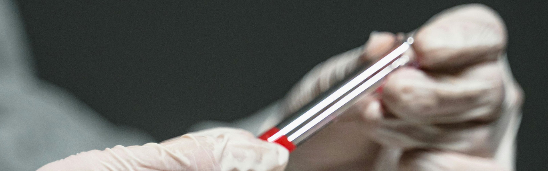 NK2R：开启肥胖与2型糖尿病新方向