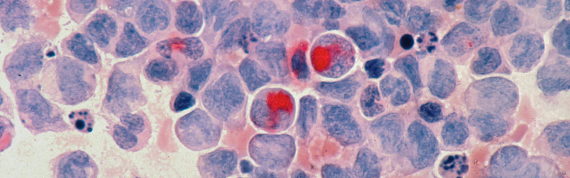 纳米抗体：揭秘TRIB2蛋白的激活态，解锁白血病治疗新路径