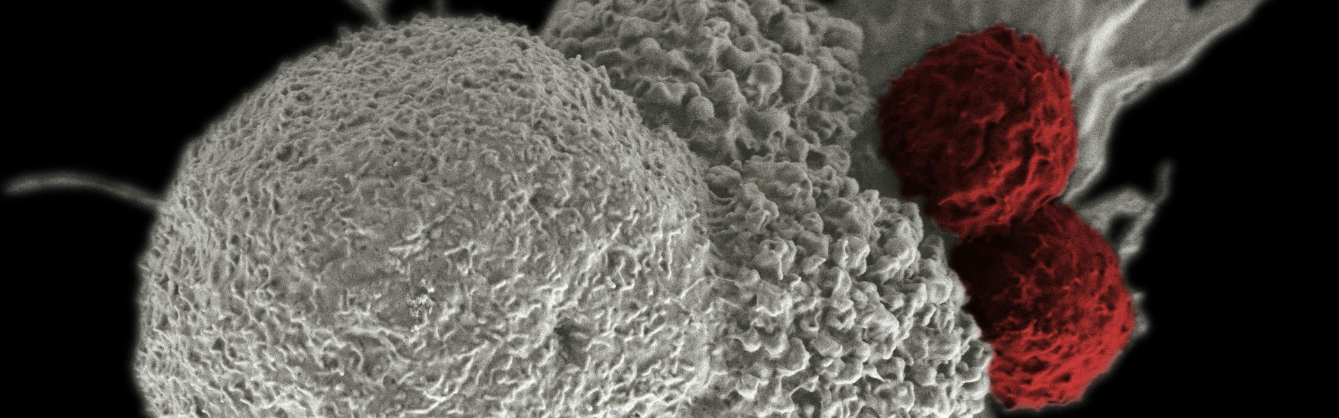 c-MET靶点临床应用到纳米抗体药物开发