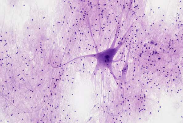 FZD3纳米抗体：精准调控癌症与神经疾病靶点