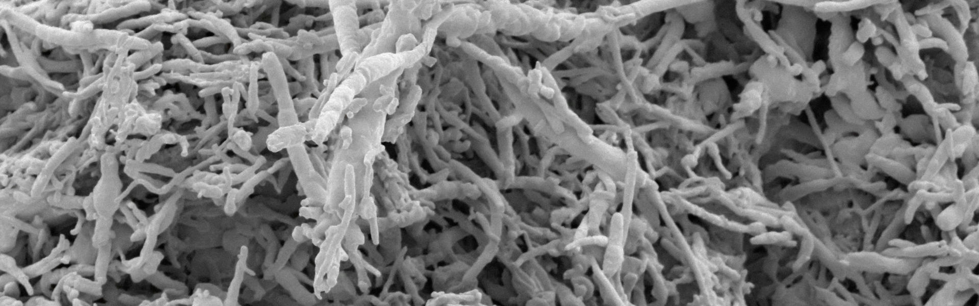 纳米抗体重塑癌症抑制蛋白p16的稳定性