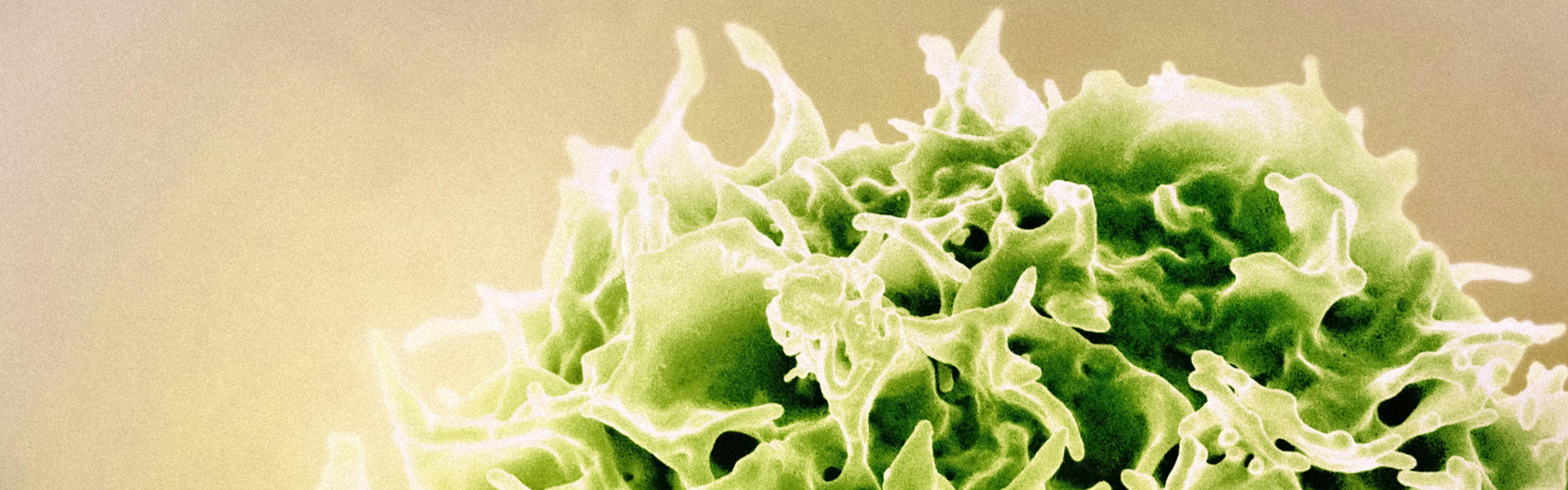 纳米抗体三特异性NK细胞衔接器：对T细胞恶性肿瘤治疗的突破性研究