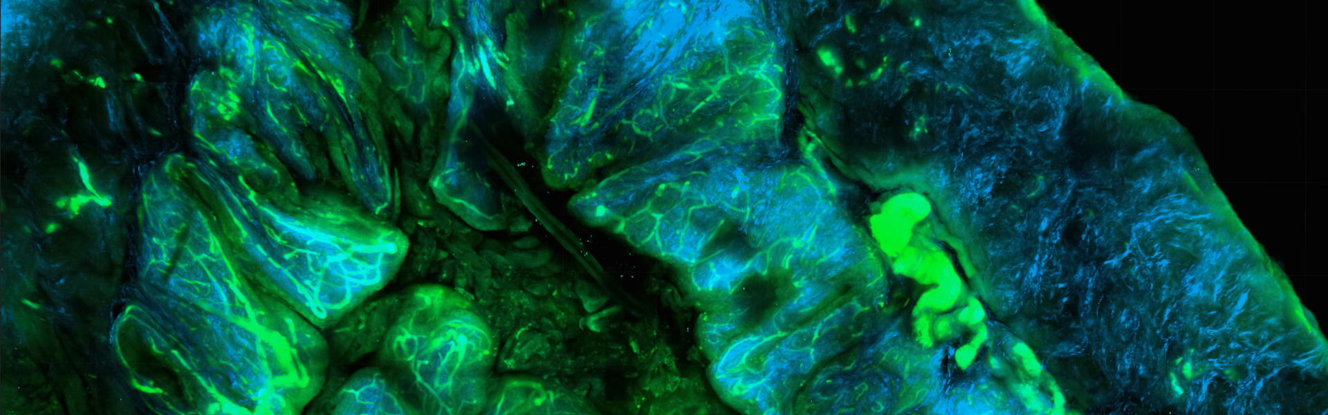 突破 “不可成药” 壁垒！纳米抗体PROTAC为YAP依赖性癌症带来新疗法